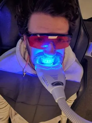 28722 teeth whitening meridian id 6