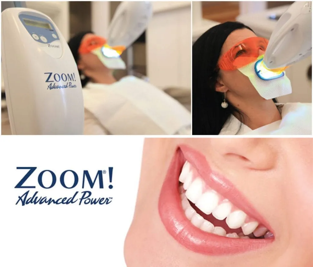 28750 teeth whitening midland mi benefits