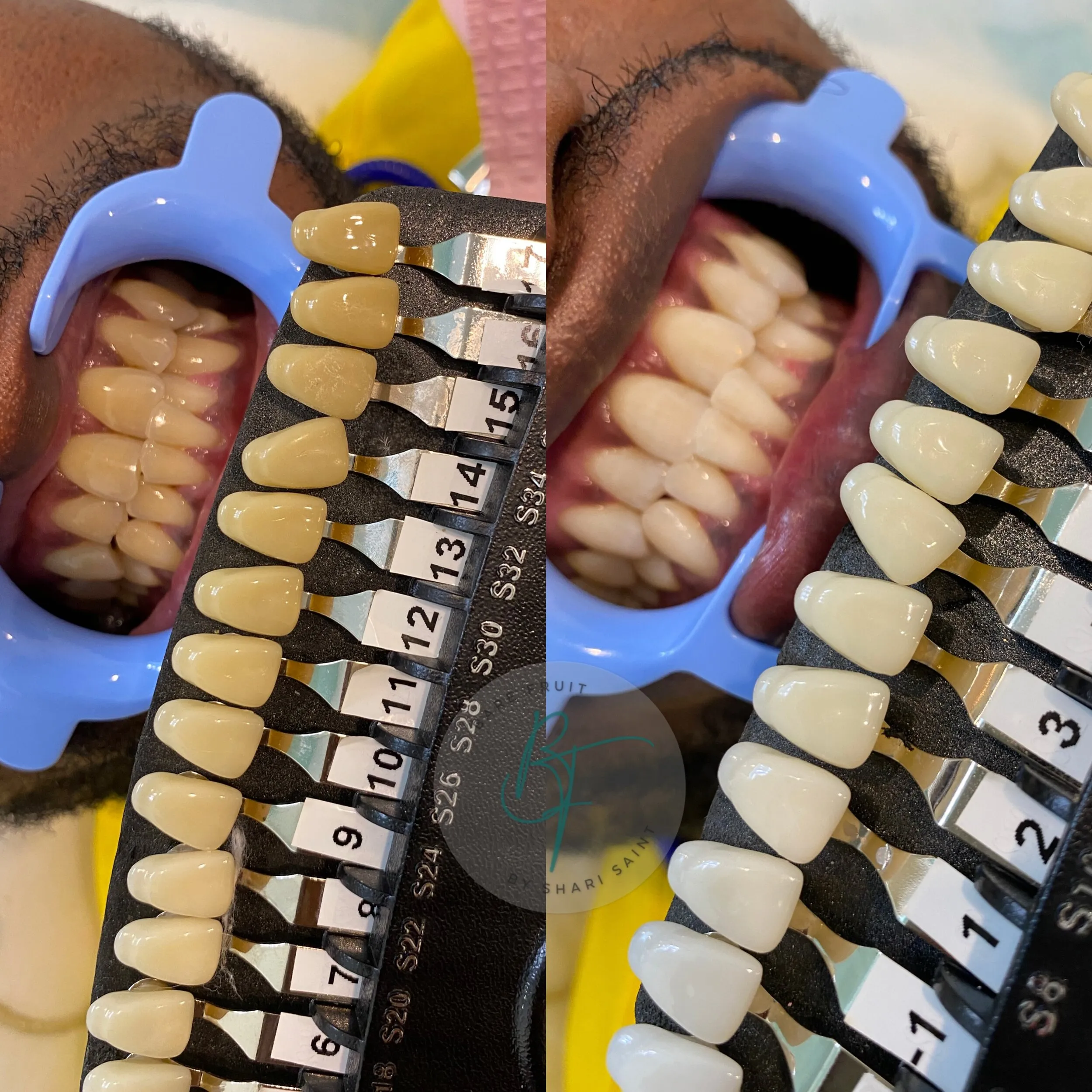 28752 oranges for teeth