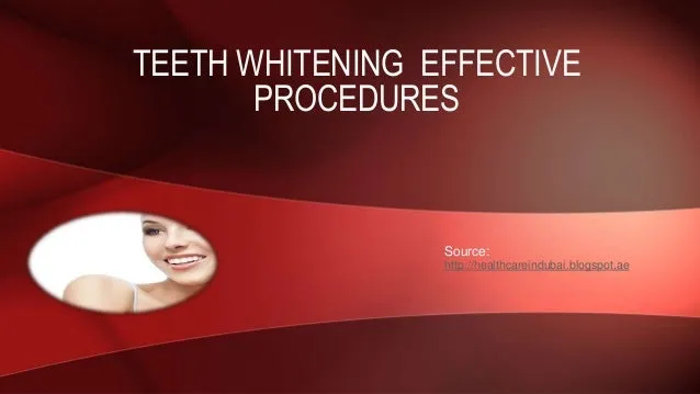 /img/28753-sensitive-teeth.webp