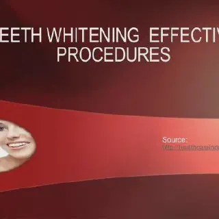 /img/28753-sensitive-teeth.webp