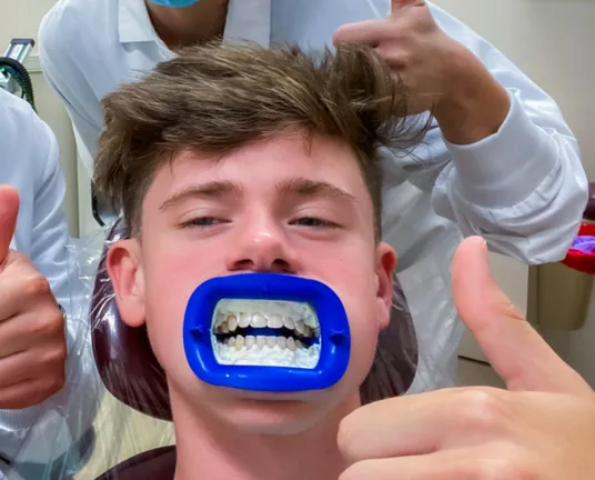 28759 at home teeth whitening